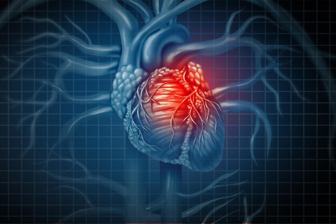 TREATING THE HEART WITH SCIENTIFIC BREAKTHROUGHS, LIFESTYLE CHANGES