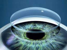 First 3D-printed human cornea developed in India