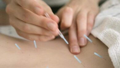 Can Acupuncture Help Control Diabetes A Closer Look at Needle Therapy and Blood Sugar