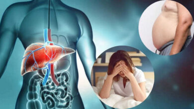 Fatty Liver Rising Among Young People Doctors Warn Not to Ignore Early Signs