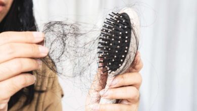 Hair Loss Warning for Men Experts Link Popular Drinks and Junk Food to Baldness Risk