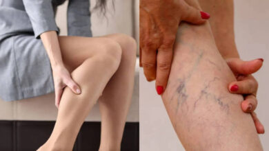 Leg Tingling Could Signal Peripheral Artery Disease Doctors Warn Against Ignoring Silent Symptoms