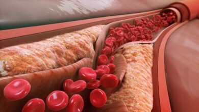 Silent Warning Signs of Rising Cholesterol and How Small Diet Changes Can Help