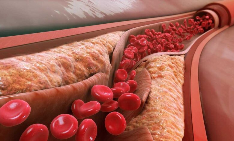 Silent Warning Signs of Rising Cholesterol and How Small Diet Changes Can Help
