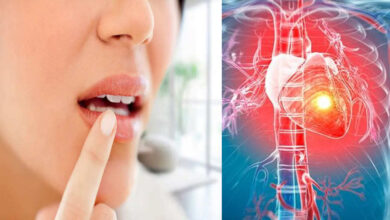 Warning Signs on Your Lips That Could Point to Hidden Heart Problems