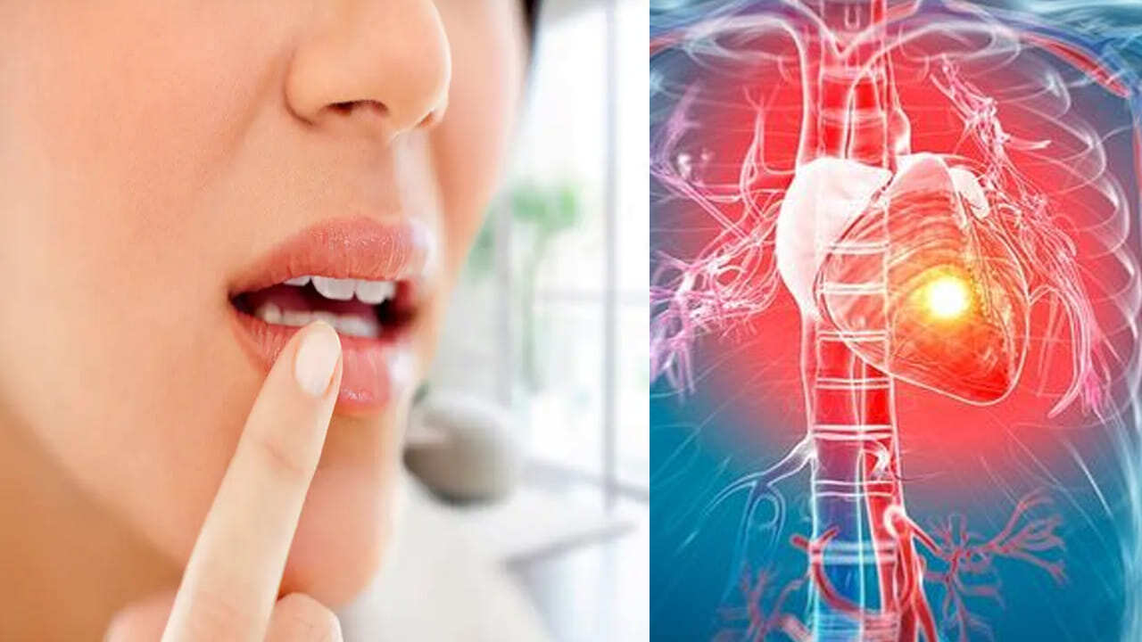 Heart Problem Lips Warning Signs on Your Lips That Could Point to Hidden Heart Problems ...