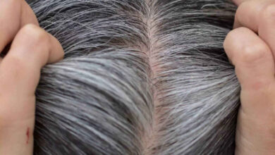 Why Hair Turns Grey Too Early Experts Explain Hidden Causes and When to Worry