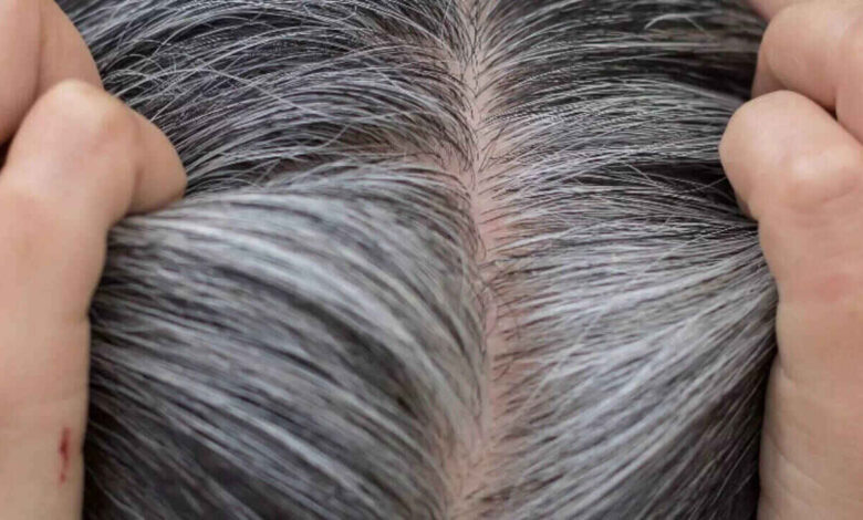 Why Hair Turns Grey Too Early Experts Explain Hidden Causes and When to Worry