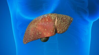 Why Liver Damage Is Rising Even Among Non Drinkers