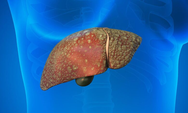 Why Liver Damage Is Rising Even Among Non Drinkers