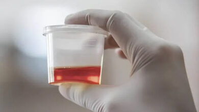 Blood In Urine A Warning Sign Of Kidney Cancer Or Something Else