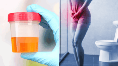 Blood in Urine Could Signal Serious Illness Experts Urge Immediate Attention