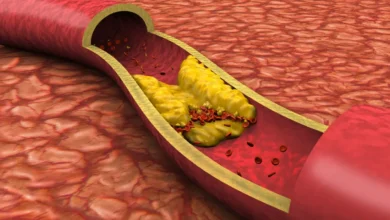 Cholesterol Control Strategies That Can Protect Your Heart Health