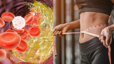 High Cholesterol Is Not Just a Problem for Overweight People Doctors Warn Thin Individuals Also at Risk