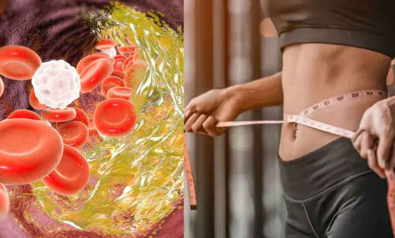 High Cholesterol Is Not Just a Problem for Overweight People Doctors Warn Thin Individuals Also at Risk