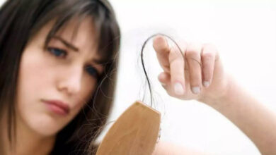 Persistent Hair Loss in Women May Signal Hidden Health Issues Experts Warn