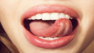 What Your Tongue Color Says About Your Health Why Doctors Always Check It First