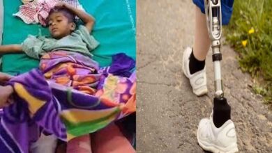 Young boy injured in Medaram temple collapse receiving support as Telangana government announces artificial limb assistance and family aid