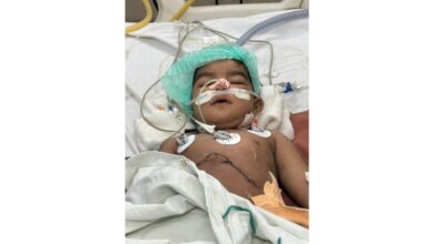 Infant recovering after liver transplant surgery at Osmania General Hospital Hyderabad with medical tubes and monitoring equipment attached