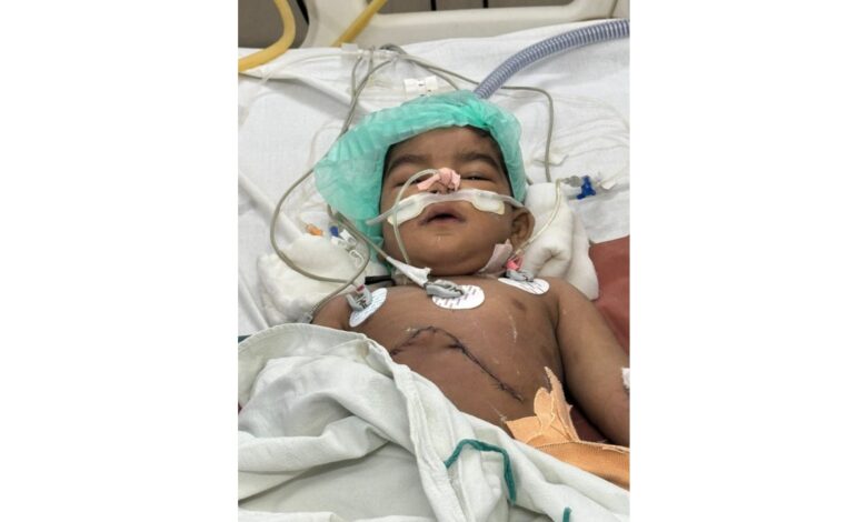 Infant recovering after liver transplant surgery at Osmania General Hospital Hyderabad with medical tubes and monitoring equipment attached