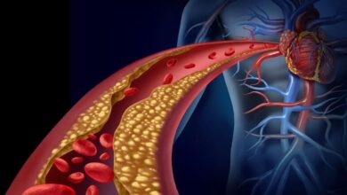 Heart Attacks Are Not Just About Cholesterol Experts Point To Gut Health Connection