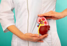Kidney Problems Rising Among Young Adults Experts Point to Fast Food and Dehydration