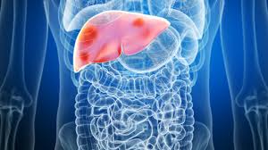Parents Warned as Fatty Liver Cases Rise Among Children