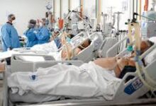 Post Covid Bone Problems Raise Concern Among Young Indians